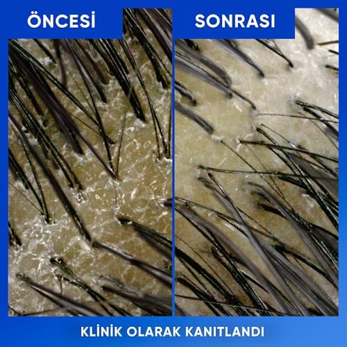 & Shoulders Arındırma ve Parlaklık Kepeğe Karşı Etkili Şampuan 800ml