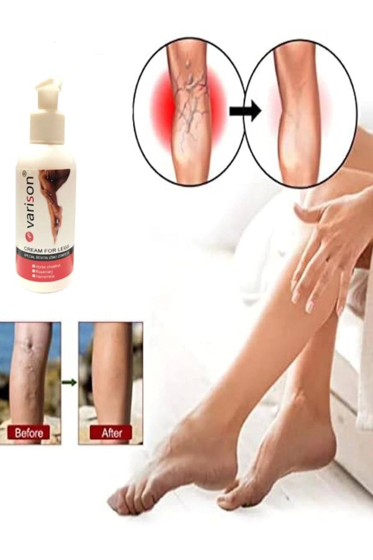 Varicose Vein Defense Var.is Bacak Bakım Kremi 120 Ml x 1 adet