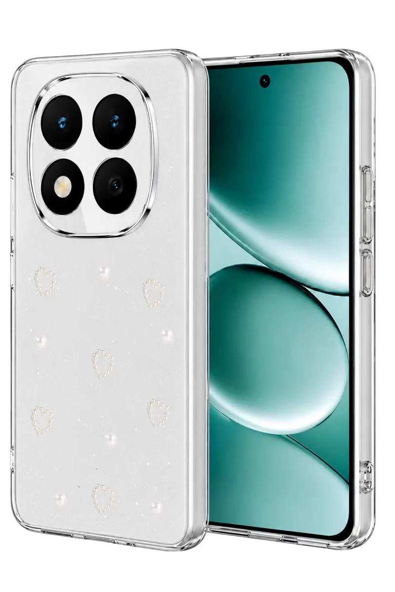 Newface Xiaomi Redmi Note 15 Pro Plus 5g Fiyonk Desenli Kapak - Desen 10