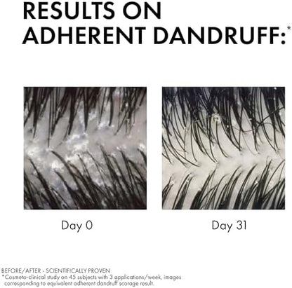Anti Dandruff Kuru Saçlar İçin Kepek Karşıtı Şampuan 200 ml