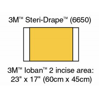 Ioban 2 - Antimikrobiyal İnsizyon Örtüsü - 56 cm x 45 cm