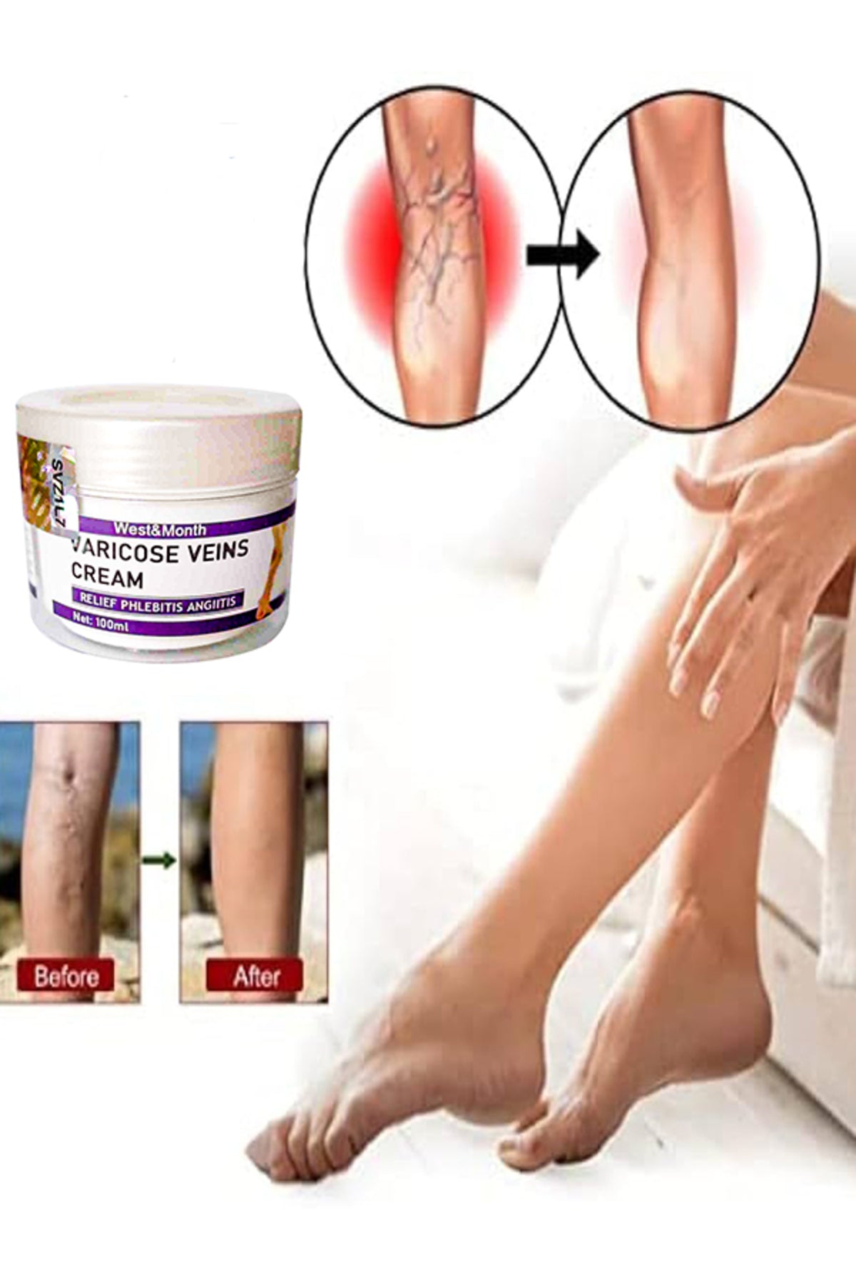 Varicose and Spider Veins Soothing Leg Cream Bacak Bakım Kremi 100 ml