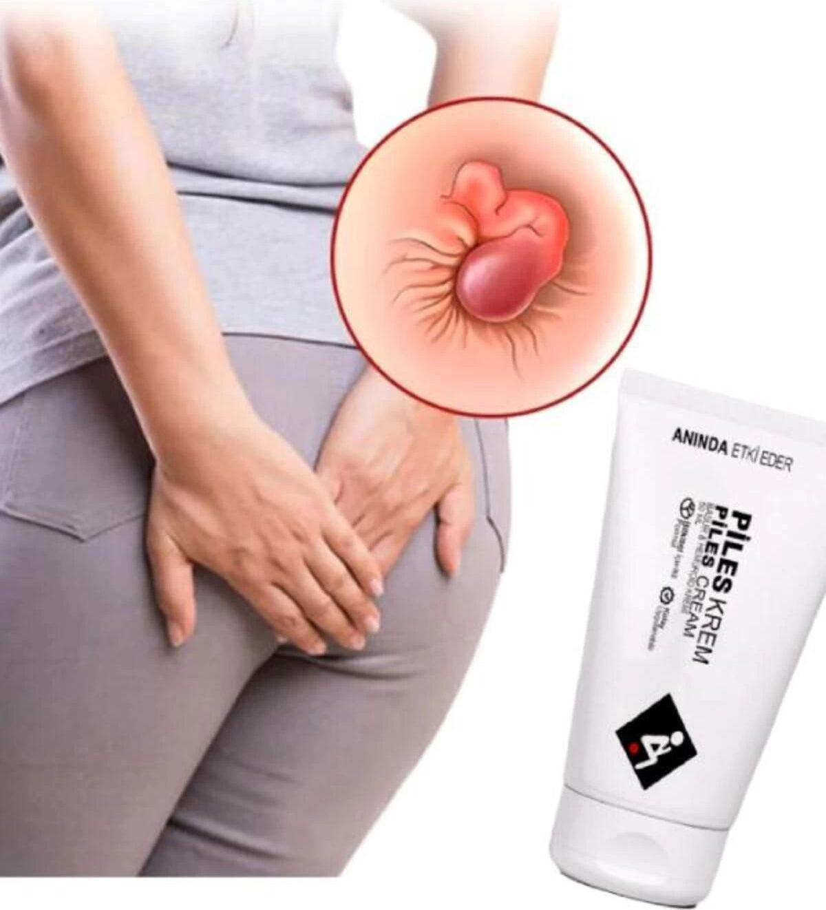 Piles Hemeroıdınız ve Bağsurunuz Için Yeni Formüllü Çözümünüzkremi 50 ml x 2 Adet