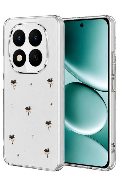 Redmi Note 15 Pro 4G Fiyonk Desenli Kapak - Desen 1